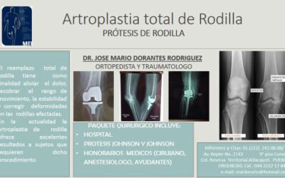 Artroplastia total de rodilla