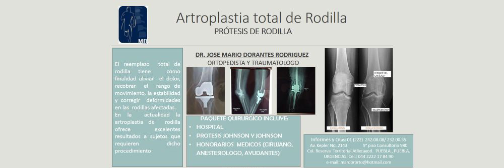 Artroplastia total de rodilla