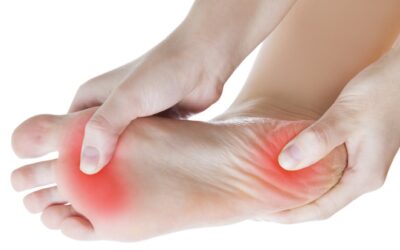 Fascitis plantar