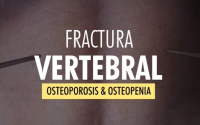 Fractura Vertebral, osteoporosis & osteopenia