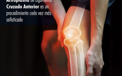 Artoplastía de Ligamento Cruzado Anterior es cada vez más sofisticado