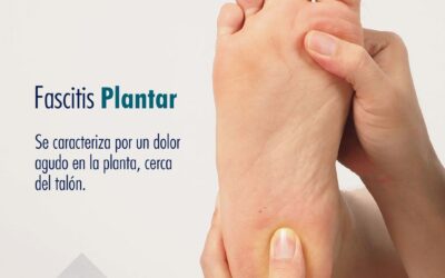 Fascitis plantar
