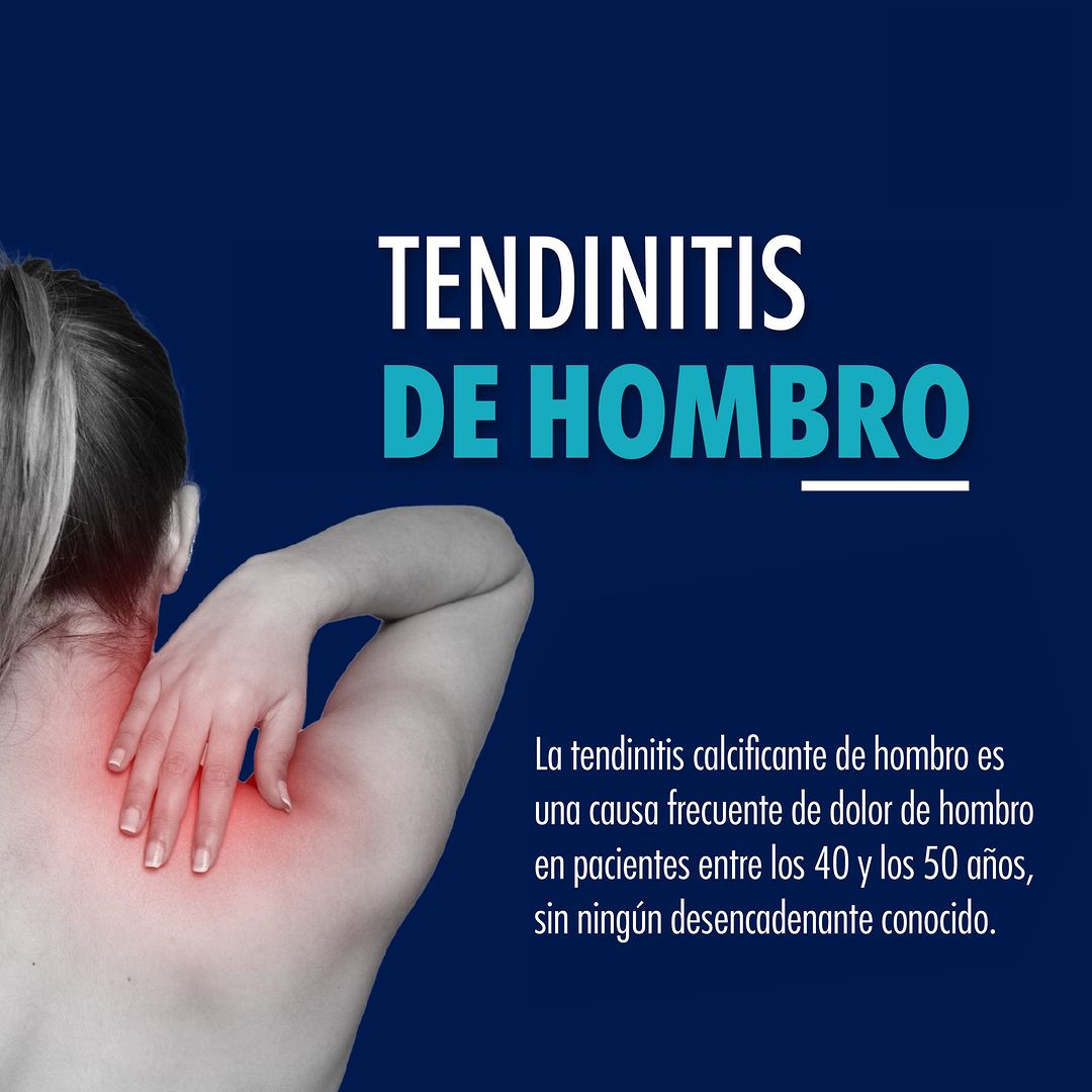 Tendinitis de Hombro