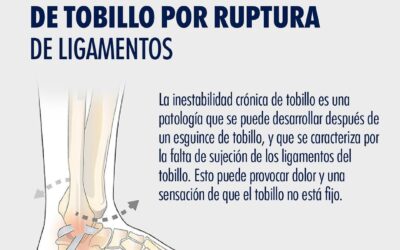 Inestabilidad Severa de Tobillo por Ruptura de Ligamentos