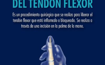 Liberación del Tendón Flexor