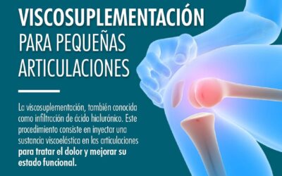 Viscosuplementación para pequeñas articulaciones