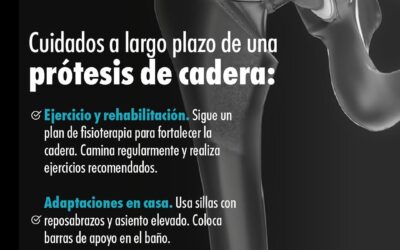 Cuidados a largo plazo de una prótesis de cadera