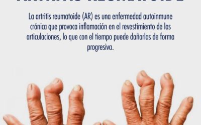 Artritis Reumatoide
