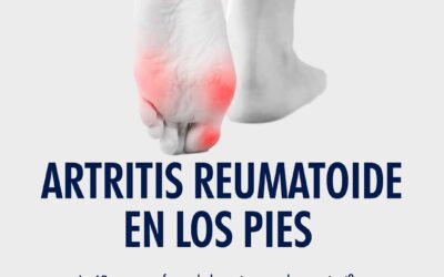 Artritis Reumatoide en los Pies