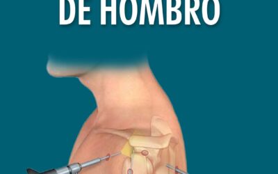 Artroscopia de Hombro
