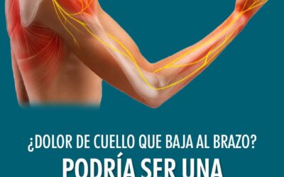 ¿Dolor de Cuello que baja al Brazo? Podría ser una cervicobraquialgia