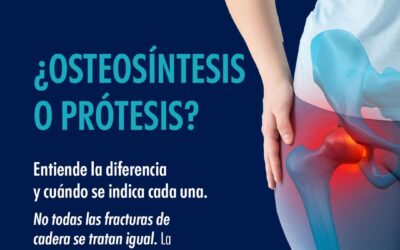 ¿Osteosíntesis o Prótesis?