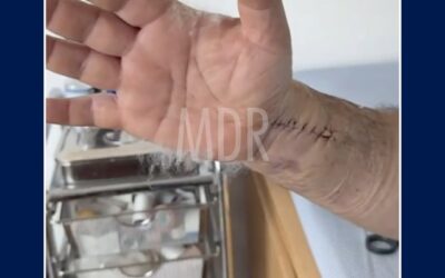 Caso de Éxito: Fractura de Muñeca