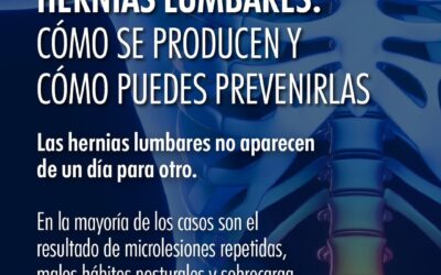 Hernias Lumbares: Cómo se producen y cómo puedes prevenirlas